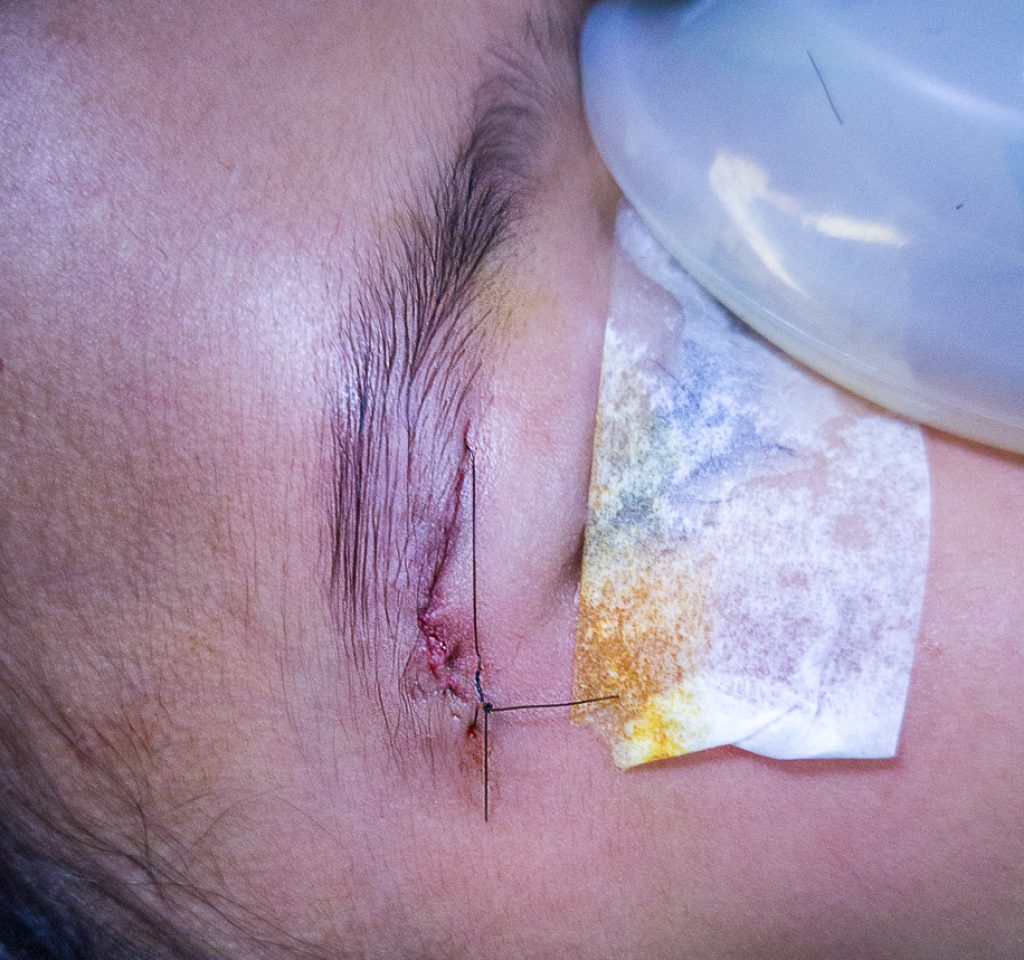 this is from oplus camera